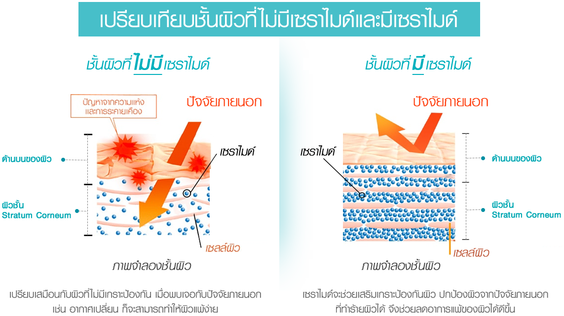 ครีมบำรุงหน้า ครีมสำหรับผิวแพ้ง่าย